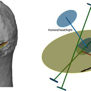 Measurements of humeral head: humeral head length, anatomical neck... | Download Scientific Diagram