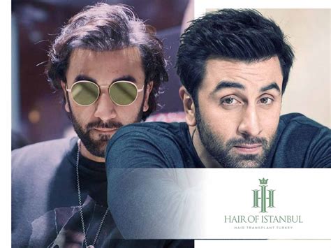 Ranbir Kapoor Hair Transplant From Speculation To Confirmation