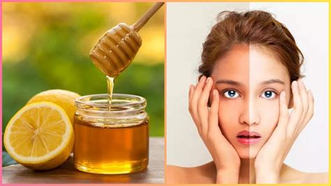 शहद और नींबू चेहरे पर लगाने के फायदे Lemon And Honey Benefits For