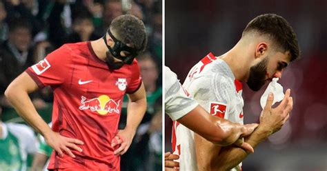 BUNDESLIGA Nema straha za SP Maskirani Joško Gvardiol odigrao je