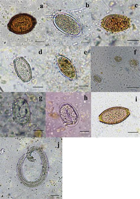 Eggs Of Helminth Species A Anatrichosoma Sp B Ancylostoma Spp