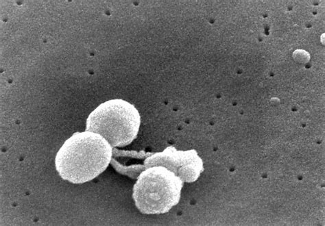 Imagem gratuita digitalização micrografia eletrônica streptococcus