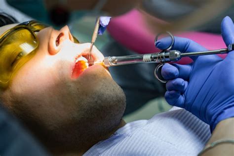 Tecnicas De Anestesia Local En Operatoria Dental Tecn