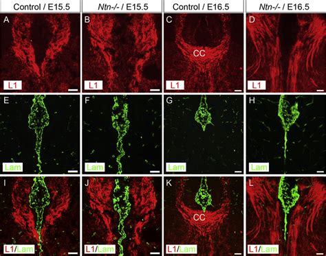 Callosal Axon Projections At The Septal Midline During Fusion Download Scientific Diagram