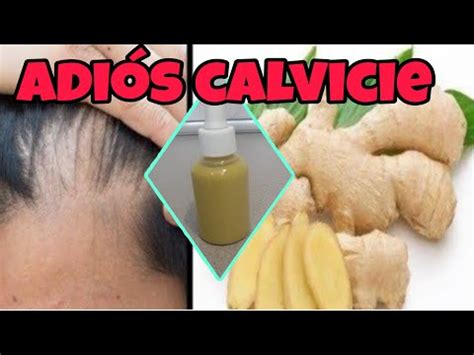 Como Usar El Jengibre Para El Crecimiento Del Cabello Zapatos Y Cia