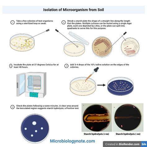 Starch Hydrolysis Test - Principle, Procedure, Results, Uses | Basic ...