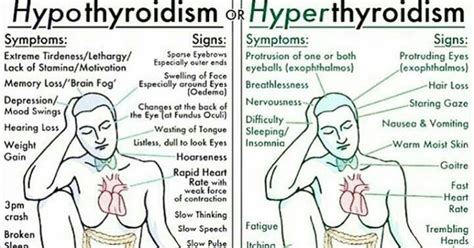 Hyperthyroidism Vs Hypothyroidism How To Detect And Treat Thyroid