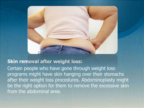 PPT Tummy Tuck Orange County Benefits Of Abdominoplasty PowerPoint