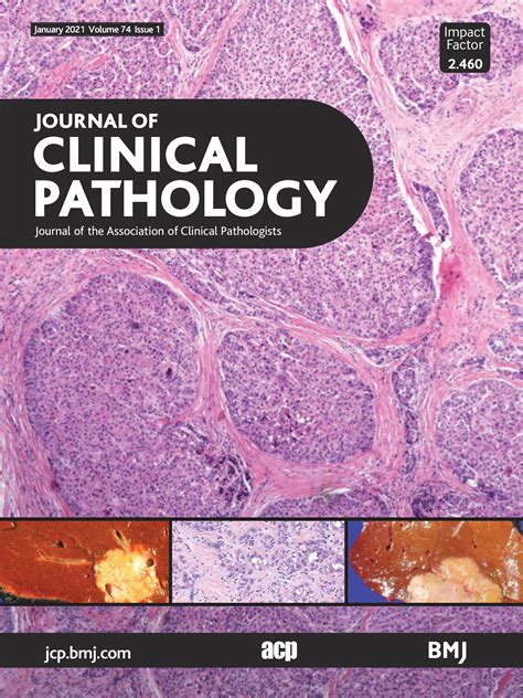 Cellular Pathology In The Covid 19 Era A European Perspective On