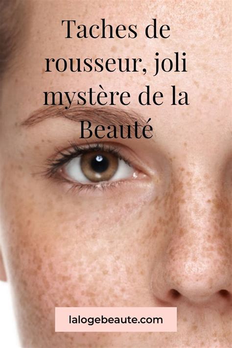 Taches de rousseur Comment les mettre en valeur La Loge Beauté en