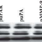 Rnai Mediated Downregulation Of Upar Upa And Mmp Reduces