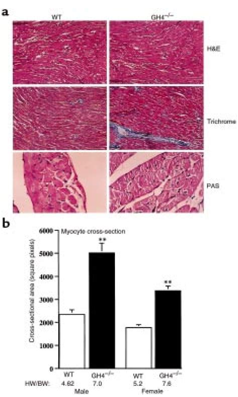 Cardiac Histology A Representative Transverse Sections Of Left