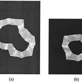 spiculation likelihood maps   spiculated