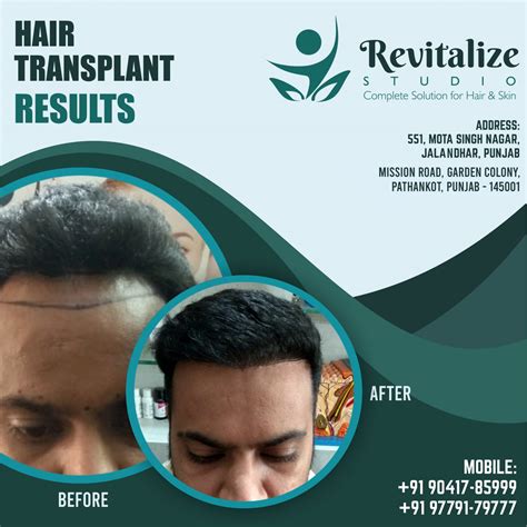 Before And After Results Revitalize Studios In Jalandhar Punjab