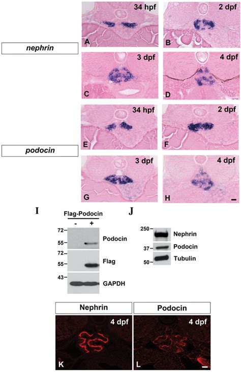 Mrna And Protein Expression Ah Mrna Expression Of Ad Nephrin And