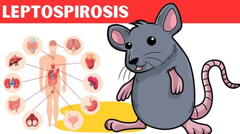 Leptospirosis Causes Risk Factors Pathology Signs And Symptoms Diagnosis And Treatment