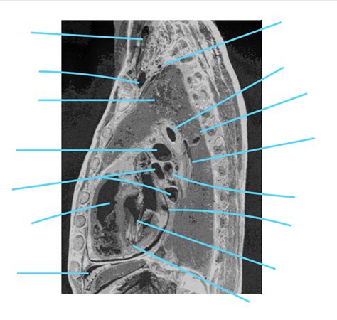 Thorax Sagittal Slide 6 Diagram Quizlet