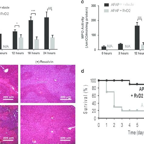 Neutrophil Depletion Attenuates Acetaminophen APAP Induced