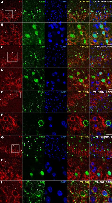 Facilitation Of Neuropathic Pain By The Npy Y Receptor Expressing