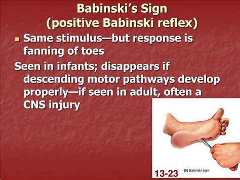 Babinski Reflex Pathway