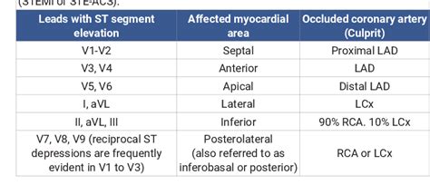 Pdf Localization Of The Occluded Vessel In Acute Myocardial