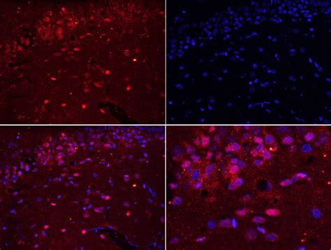 Rabbit Anti Aif Polyclonal Antibody Absin