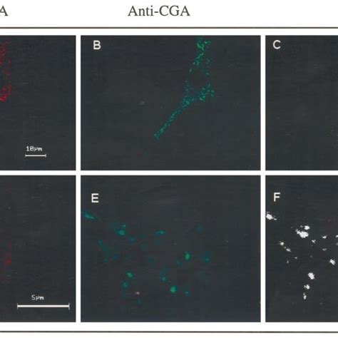 Intracellular Distribution Of RhoA In Cultured Chromaffin Cells Double