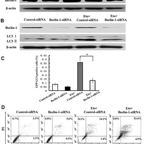 Autophagy Inhibition By 3ma Enhances Etoposide Induced Cell Death A