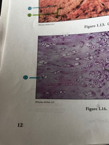 Hyaline cartilage slide Flashcards | Quizlet