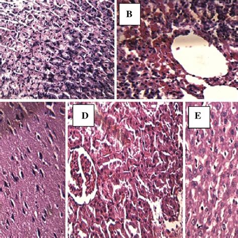 Histopathological Analysis Of Rat Organs From The Acute Toxicity Test