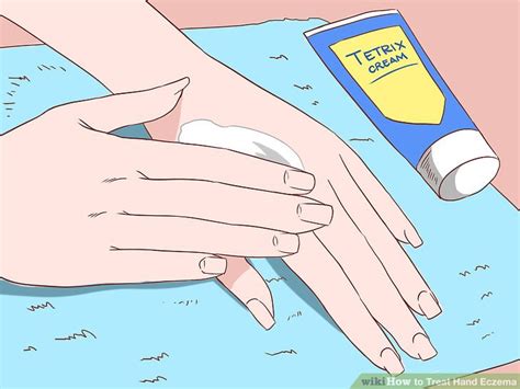 3 Ways To Treat Hand Eczema Wikihow