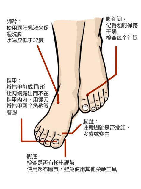 得了糖尿病，可要更加關愛你的腳哦！糖尿病足的小tip 每日頭條