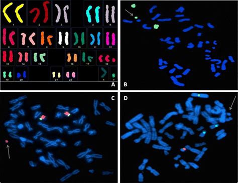 Molecular Cytogenetic Characterization Of The Marker Chromosome Arrows