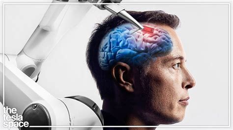 又一驚人舉動 Elon Musk 表示 Neuralink 將於今年底為大腦植入晶片進行首次人體試驗 Xfastest Hong Kong