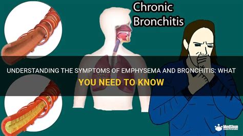 Understanding The Symptoms Of Emphysema And Bronchitis What You Need To Know Medshun