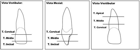 Introdução à Anatomia Dental Parte 2 Divisão Dos Dentes Em Terços E