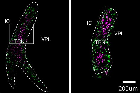 Mapping The Brain’s Sensory Gatekeeper Mit News Massachusetts Institute Of Technology