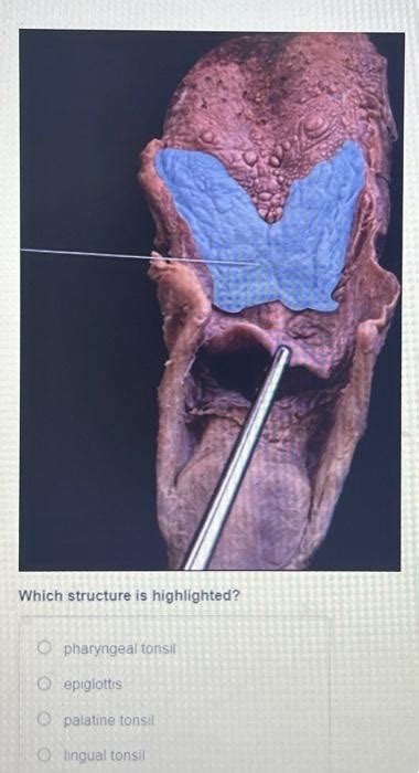 Solved Which Structure Is Highlighted Pharyngeal Tonsil Chegg