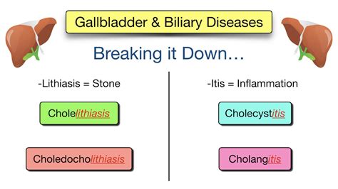 Coledocolitiasis Vs Colelitiasis