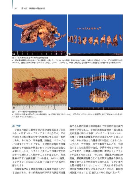 楽天ブックス 卵巣腫瘍・卵管癌・腹膜癌 改訂・改題第2版腫瘍病理鑑別診断アトラス 清川 貴子 9784830622694 本