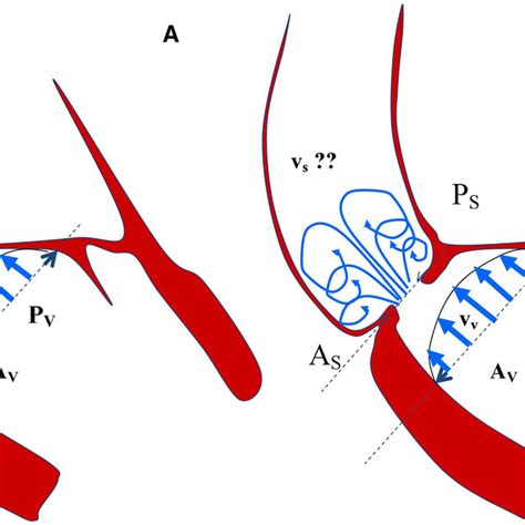 A Schematic And Ideal Representation Of Left Ventricle Aortic Valve Download Scientific