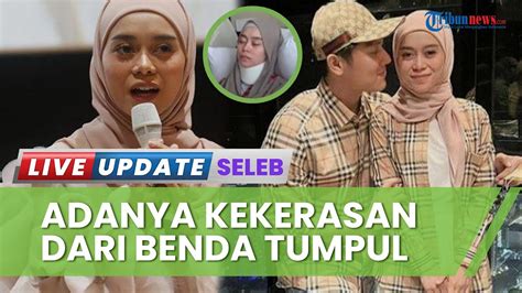 Hasil Visum Lesti Kejora Terbongkar Alami Kekerasan Benda Tumpul