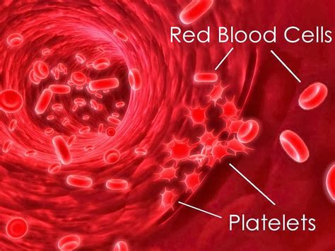 Thrombocytopenia - Causes, Signs, Symptoms, Diagnosis, Treatment