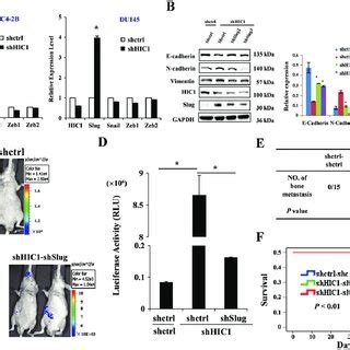 Slug Is Involved In The EMT Process Related To HIC1 Loss A Relative