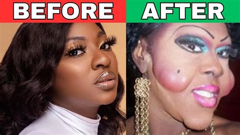 10 Plastic Surgeries Or Bbl Gone Wrong And Led To Death Youtube