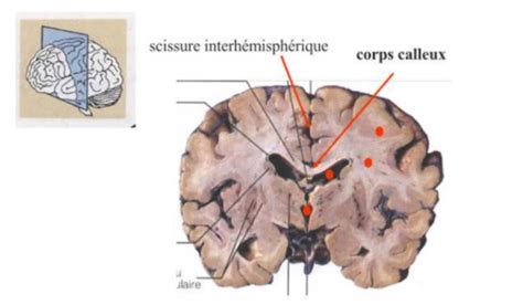 Chapitre Les Cortex Cartes Quizlet