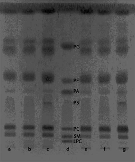 Image Of A Developed Tlc Plate Containing Samples From Rat And Pig