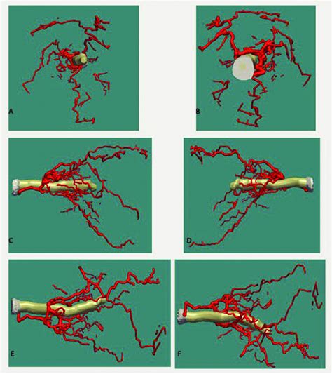 Three-D reconstruction of retrobulbar arterial system in relation to... | Download Scientific ...