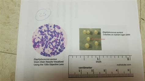 Staphylococcus Aureus Gram Stain 100x