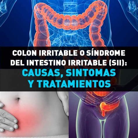 Colon Irritable O S Ndrome Del Intestino Irritable Sii Causas